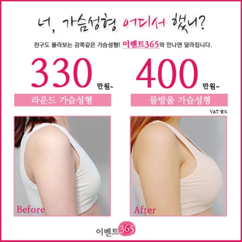 이벤트365의원